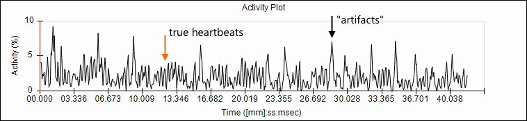 Activity plot showing false peak detection