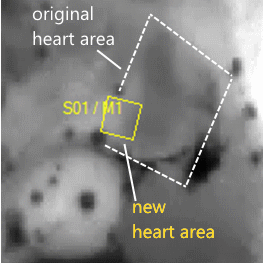 Correctly defined heart area