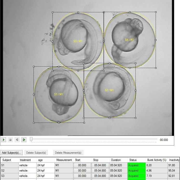 Zebrafish embryo's under microscope